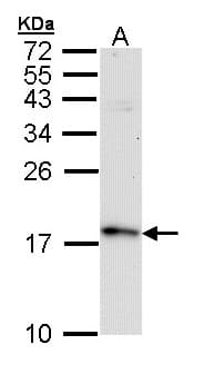 Polyclonal Rabbit anti-Human FIS1 Antibody (aa1-152, IHC, WB)