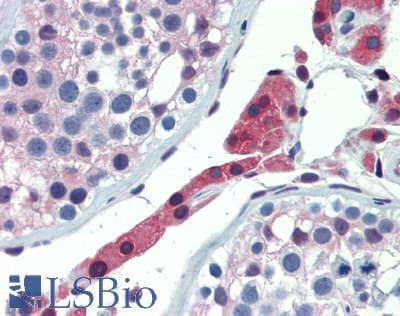 IHC-plus™ GLO1 / Glyoxalase I Antibody (aa83-184)