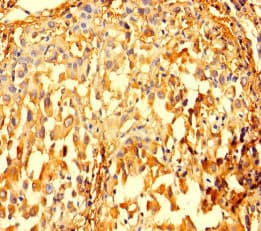 IMPDH2 Antibody