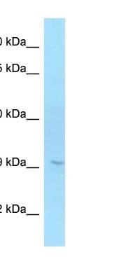 ELOVL6 Antibody (C-Terminus)