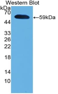 IFNA5 / Interferon Alpha 5 Antibody (aa22-189)