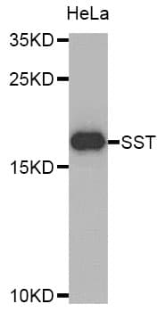 Polyclonal Rabbit anti-Human SST / Somatostatin Antibody (WB)