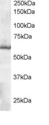 IHC-plus™ TRXR1 / TXNRD1 Antibody (aa600-612)