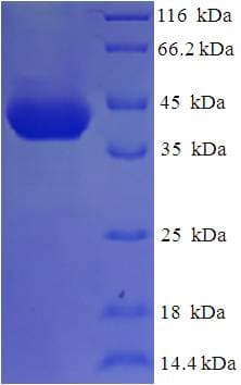 Human MRDS1 / OFCC1 Protein (Recombinant His-SUMO)