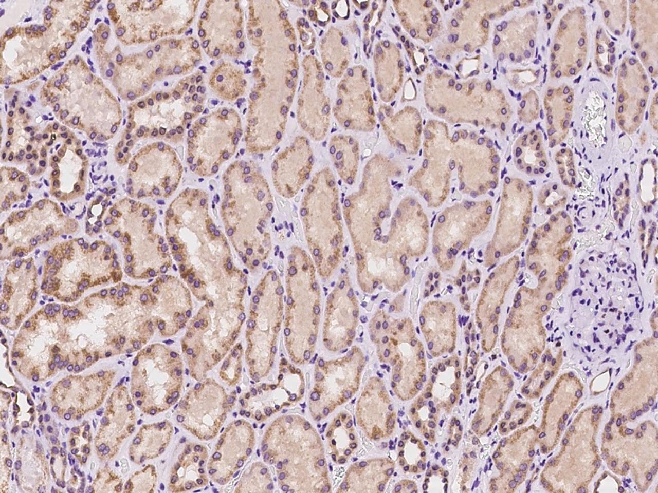 Polyclonal Rabbit anti-Human PADI3 Antibody (IHC)