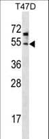 Polyclonal Rabbit anti-Human ZDHHC6 Antibody (aa288-317, WB)