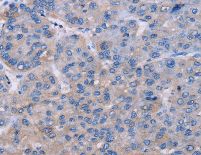 Polyclonal Rabbit anti-Human NR1D1 Antibody (IHC)