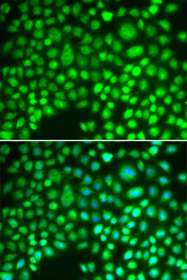Polyclonal Rabbit anti-Human Aprataxin / APTX Antibody (IHC, IF, WB)