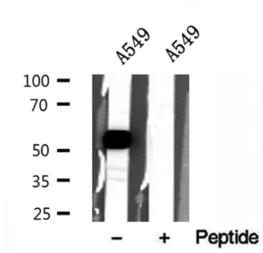Polyclonal Rabbit anti-Human SLC30A7 Antibody (IHC, WB)