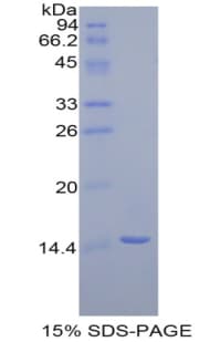 Mouse PPARD / PPAR Delta Protein (Recombinant His)