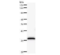 Monoclonal Mouse anti-Human FBXL4 / FBL5 Antibody (clone 2352C1a, WB)