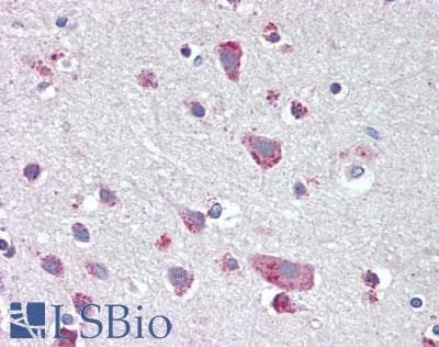 IHC-plus™ Monoclonal Rabbit anti-Human CXCR4 Antibody (IHC, WB)