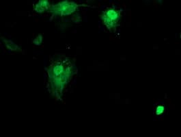 SMS / Spermine Synthase Antibody (clone OTI 5F9, Carrier-free)