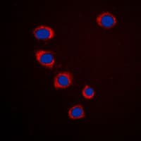 Polyclonal Rabbit anti-Human EFNA3 / Ephrin A3 Antibody (C-Terminus, IF, WB)