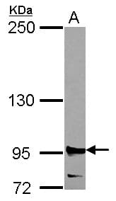 R1 / RRM1 Antibody