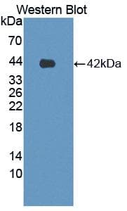 ADGRL3 / LPHN3 Antibody (aa1105-1447)