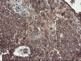 GCP60 / ACBD3 Antibody (clone OTI1B5)