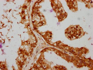SAV1 / WW45 Antibody