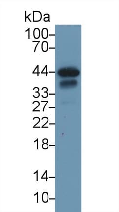 TNNT2 / CTNT Antibody (aa1-289)