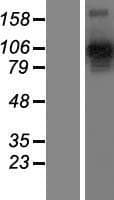 NRP2 / Neuropilin 2 Protein (Over-Expression Lysate Myc-DDK (Flag))