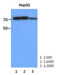 PFKM / PFK-1 Antibody (clone AT2F11)