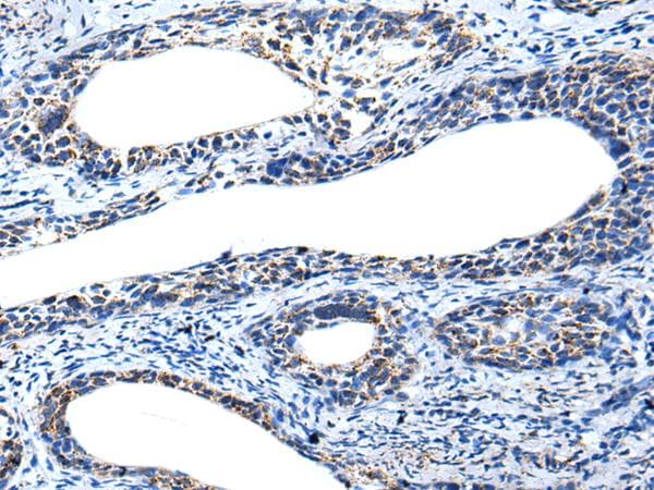 Polyclonal Rabbit anti-Human IRF5 Antibody (IHC, WB)