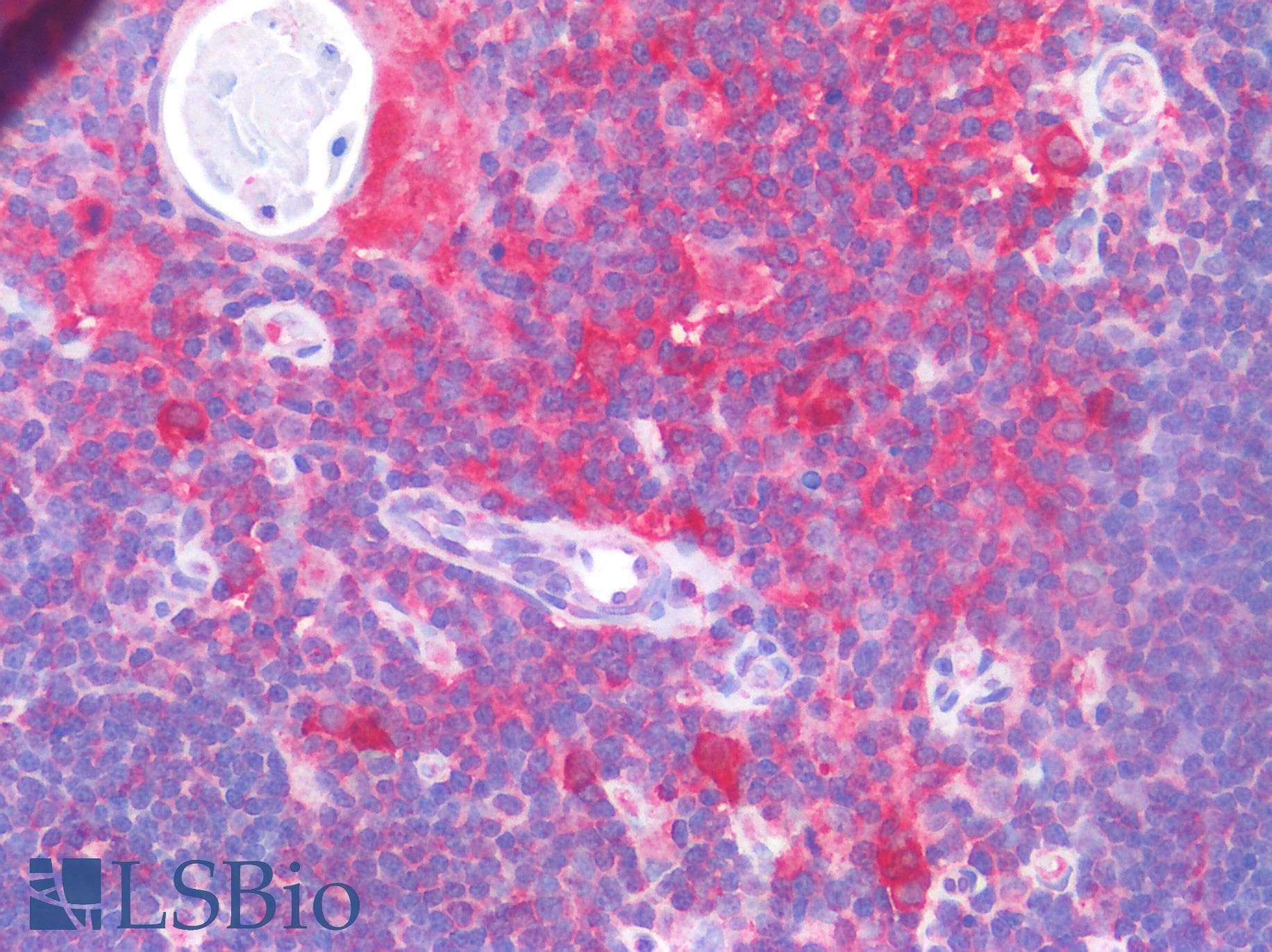 IHC-plus™ Polyclonal Rabbit anti-Human CD33 Antibody (IHC)