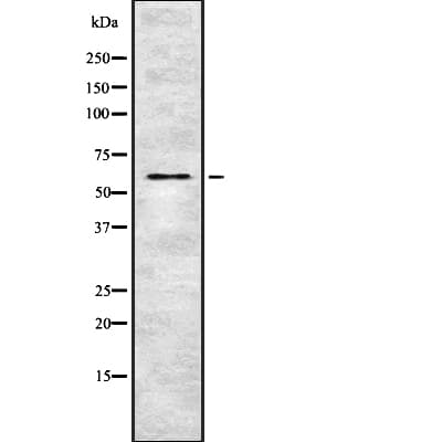 OXSR1 / OSR1 Antibody (phospho-Thr185)