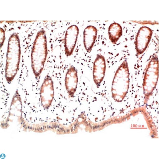 Collagen I Antibody