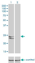 RAB27A / RAB27 Antibody (clone 1G7)