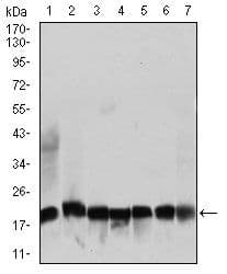Monoclonal Mouse anti-Human RPL18A Antibody (clone 6G6G10, Amino Acid: 50-176, IHC, IF, WB)