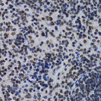 Polyclonal Rabbit anti-Human ID3 Antibody (IHC, IF, WB)