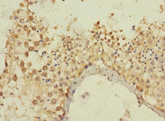 Polyclonal Rabbit anti-Human MLLT10 Antibody