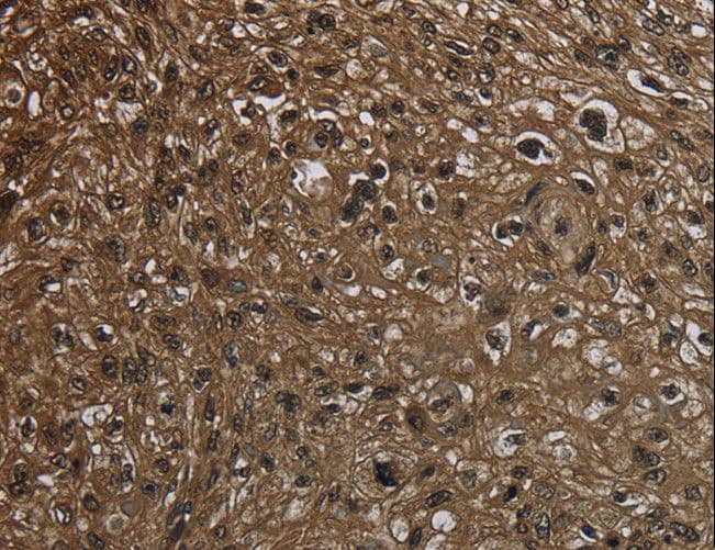 Polyclonal Rabbit anti-Human GLO1 / Glyoxalase I Antibody (IHC, WB)