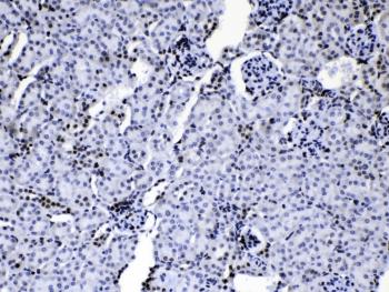 HNRPA1 / HnRNP A1 Antibody