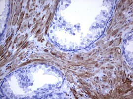 Monoclonal Mouse anti-Human CD30 Antibody (clone OTI9H7, IHC, WB)
