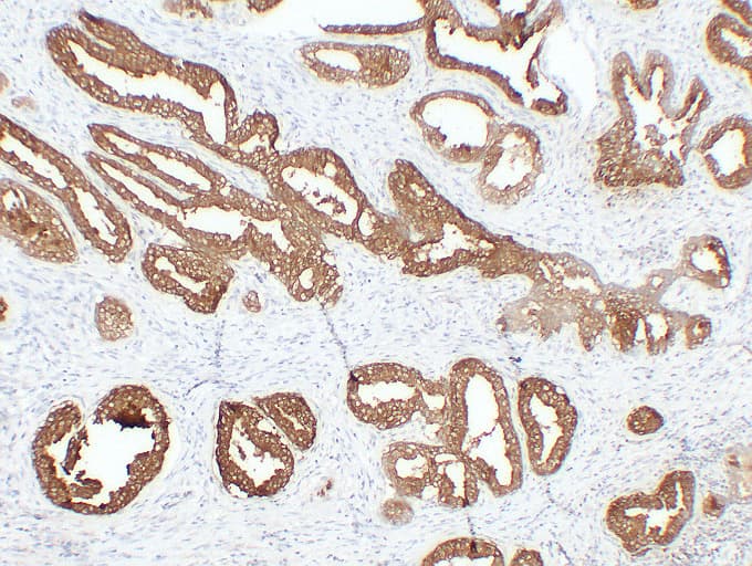 Monoclonal Mouse anti-Human ACPP / PAP Antibody (clone ABT-PSAP, IHC)