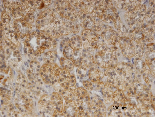 Monoclonal Mouse anti-Human Yo / CDR2 Antibody (clone 1F8, IHC, WB)