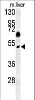 Polyclonal Rabbit anti-Human SNX31 Antibody (aa57-85, WB)