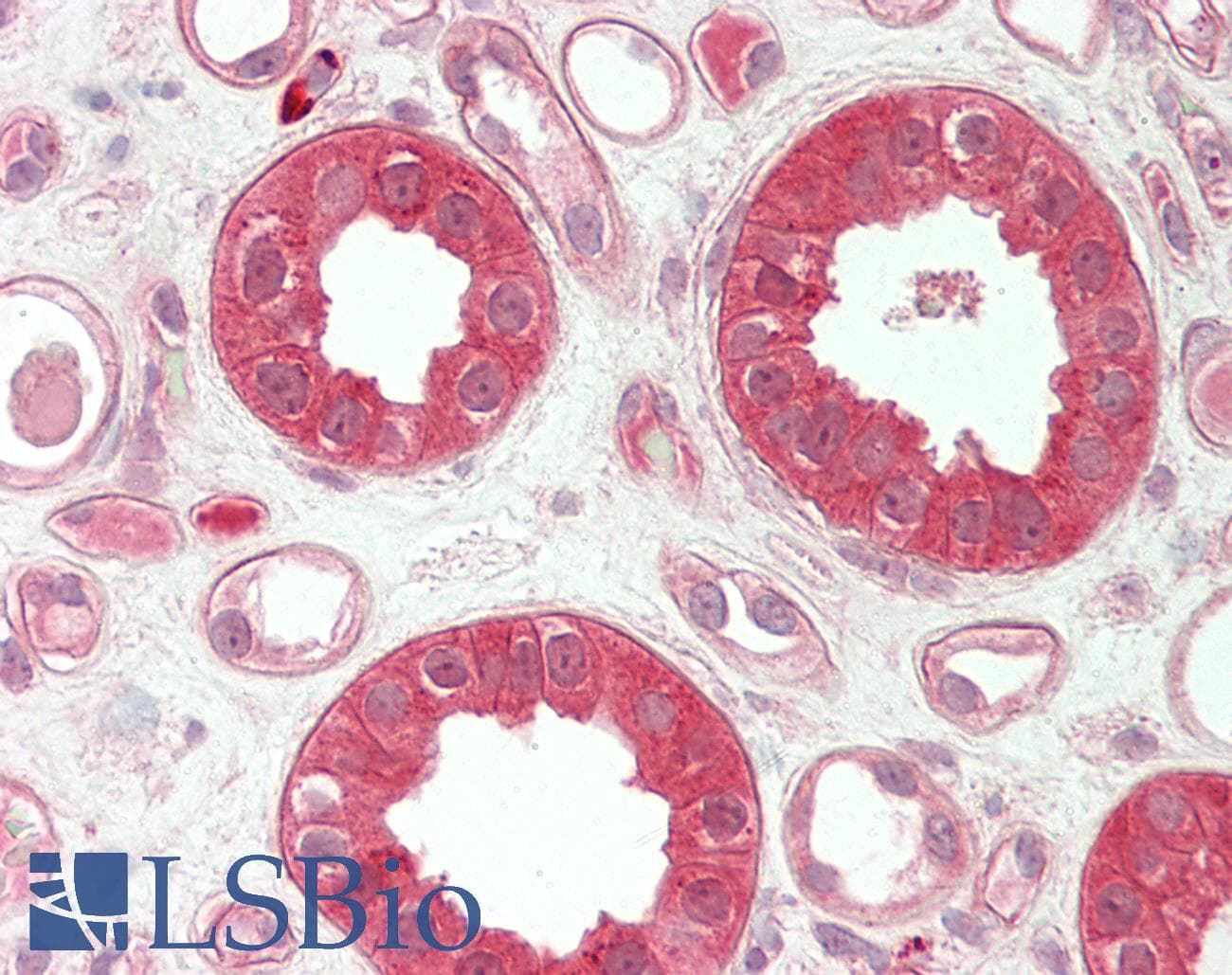 Polyclonal Rabbit anti-Human TMPRSS4 Antibody (aa71-120, IHC, WB)