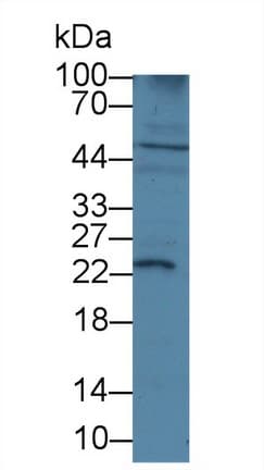 IGF1 Antibody (aa49-118, FITC)