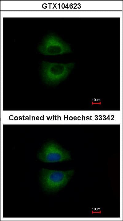 GRAP Antibody (aa155-217)