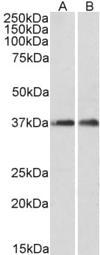 IHC-plus™ ARPC1A Antibody (aa356-368)