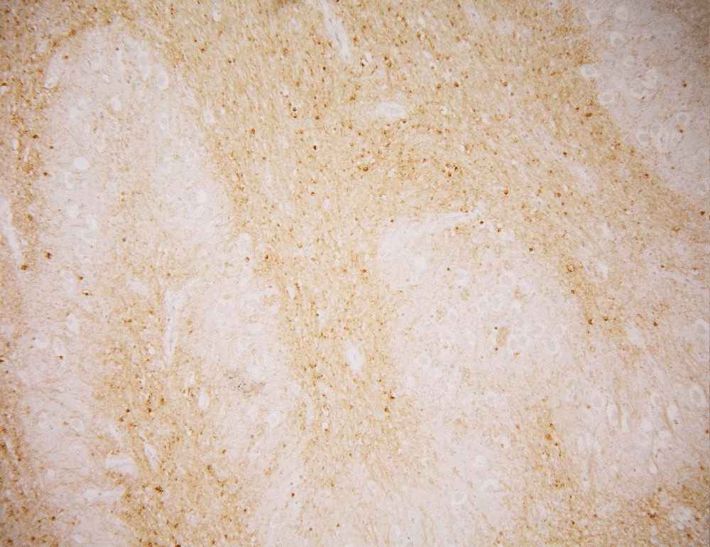 FOLH1 / PSMA Antibody (clone GCP-04)