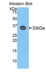 TLR1 Antibody (aa114-339)