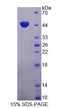 Human ISLR Protein (Recombinant His, N-Terminal)