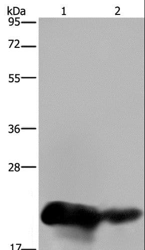 Polyclonal Rabbit anti-Human CSH1 / Placental Lactogen Antibody (IHC, WB)