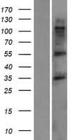 TMCC3 Protein (Over-Expression Lysate Myc-DDK (Flag))