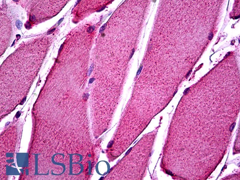 IHC-plus™ Polyclonal Rabbit anti-Human ATP11B Antibody (IHC, IF, WB)