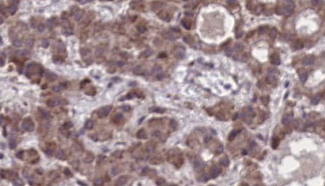 Polyclonal Rabbit anti-Human SSTR3 Antibody (IHC, WB)